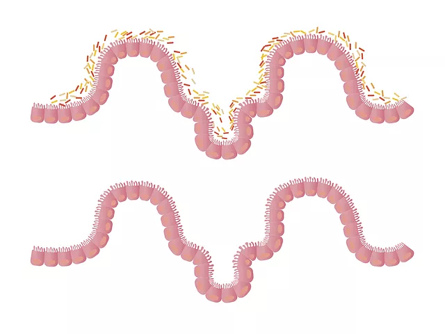 La flora intestinal